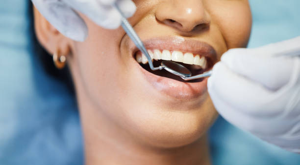 Best Broken or Cracked Tooth Emergency Dentist in Thorofare, NJ